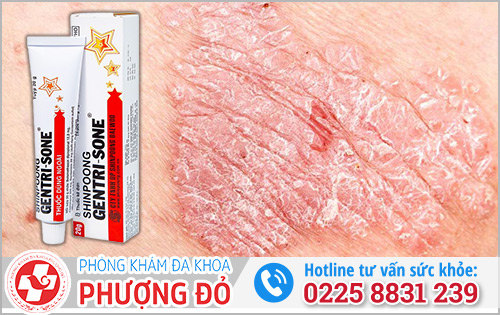 Kem bôi trị ngứa vùng kín nam giới