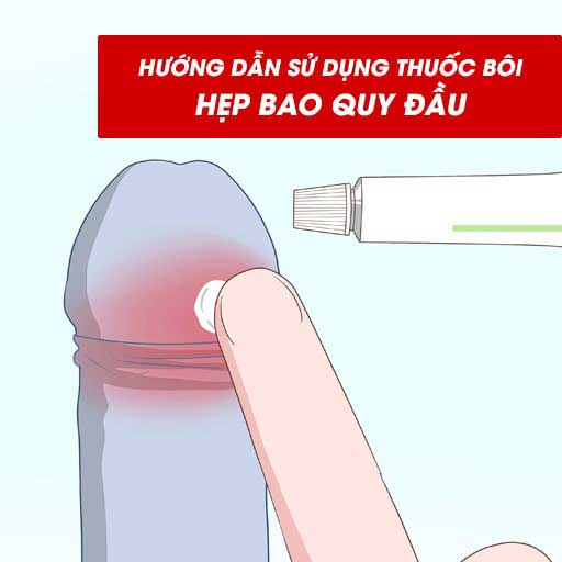 Hướng dẫn sử dụng thuốc bôi hẹp bao quy đầu cho người lớn