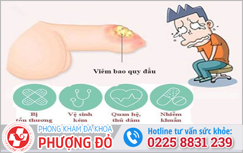 Bị ngứa và đi tiểu buốt ở nam giới là bệnh viêm bao quy đầu