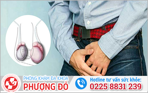 Tinh hoàn bên trái to hơn bên phải có sao không?