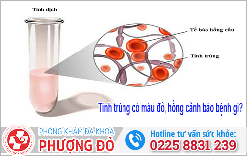 Tinh trùng có màu đỏ, hồng cảnh báo bệnh gì?