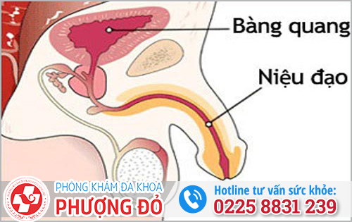 Xuất tinh có màu đỏ do bệnh viêm niệu đạo