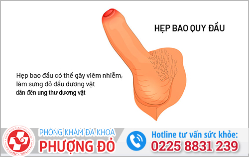 Nguyên nhân và các yếu tố làm tăng nguy cơ mắc bệnh