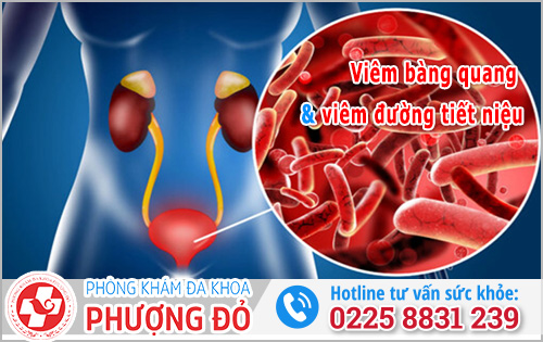 Viêm đường tiết niệu có phải viêm bàng quang không?