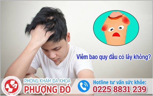 Viêm bao quy đầu có lây không?