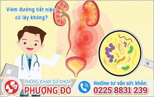 Viêm đường tiết niệu có lây không?