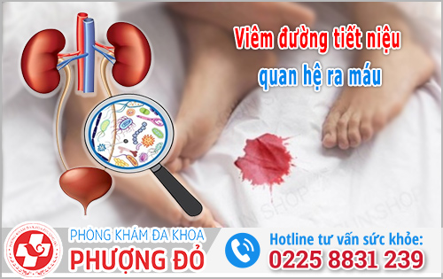 Viêm đường tiết niệu quan hệ ra máu 