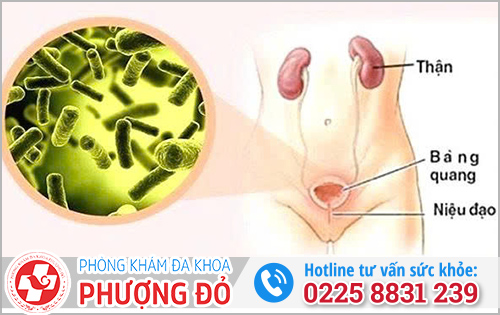 Nguyên nhân viêm đường tiết niệu quan hệ ra máu