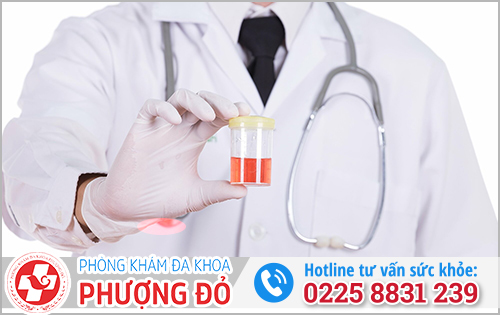Cách tránh bị viêm tiết niệu tiểu ra máu lại tái phát
