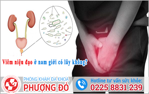 Viêm niệu đạo ở nam giới có lây không? 