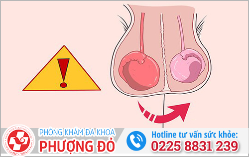 Viêm tinh hoàn bên phải nguyên nhân do đâu?