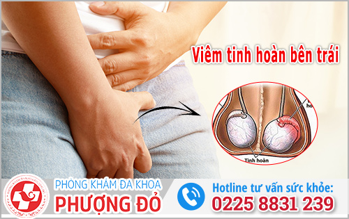 Viêm tinh hoàn bên trái