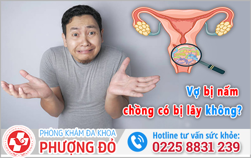 Vợ bị nấm chồng có bị lây không? 