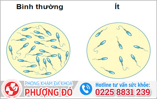 Tinh trùng như nào là vô sinh?