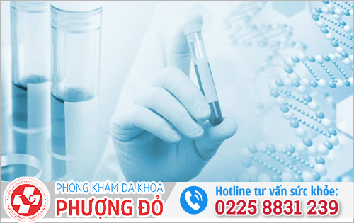Xét nghiệm dịch niệu đạo nam giới