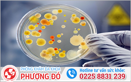 Soi tươi dịch niệu đạo