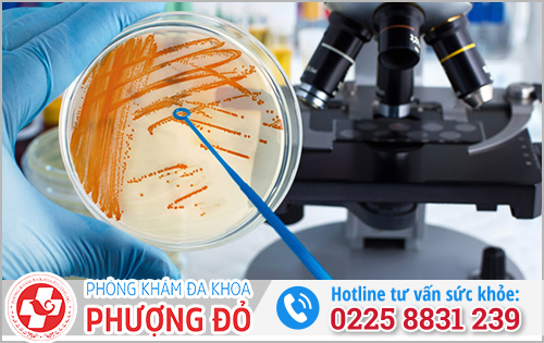 Lấy dịch niệu đạo nam soi dưới kính hiển vi