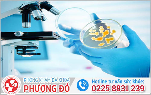 Quy trình xét nghiệm dịch niệu đạo