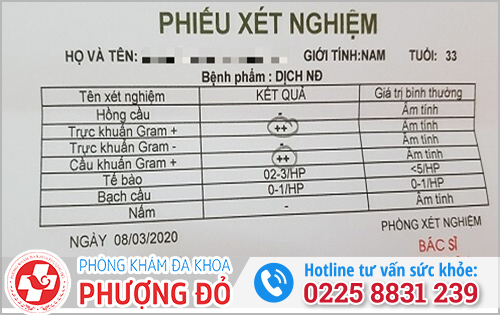 Cách đọc phiếu kết quả xét nghiệm dịch niệu đạo