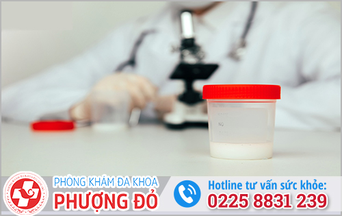 Quy trình xét nghiệm tinh dịch đồ