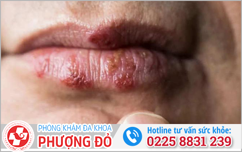 Hôn cô bé nhiều có tốt không?