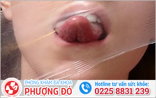 Giải pháp an toàn khi quan hệ bằng miệng