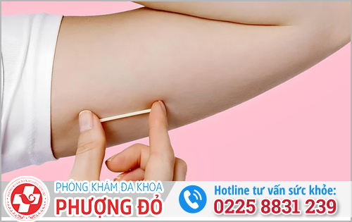 Những cách tránh thai hiệu quả