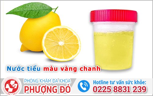Nước tiểu màu vàng chanh