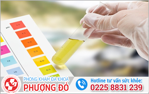 Nước tiểu màu vàng chanh là bị gì?