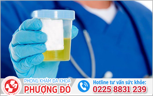 Đi khám khi thấy nước tiểu màu vàng chanh (vàng tươi)