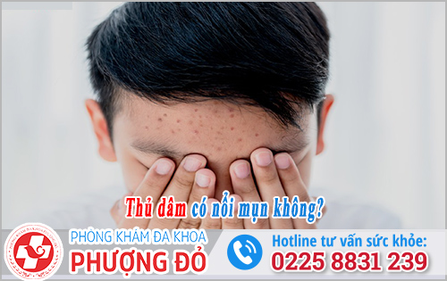 Thủ dâm có nổi mụn không?