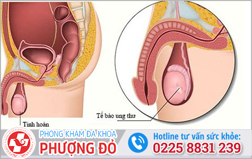 Thủ dâm bị đau bụng dưới